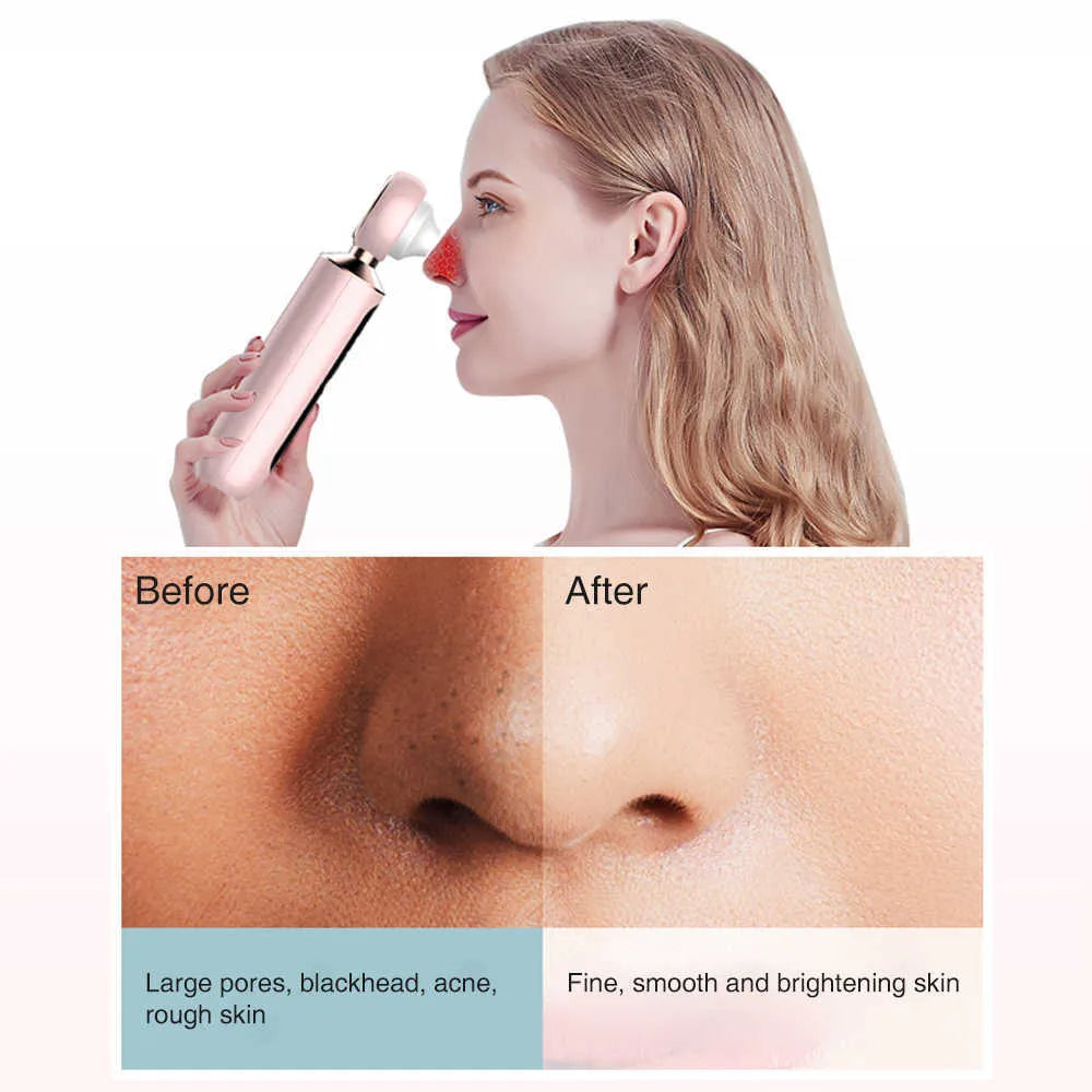 𝘼𝙧𝙖𝙗𝙞𝙖𝙣 𝙑𝙖𝙪𝙡𝙩™ Blackhead Suction Machine